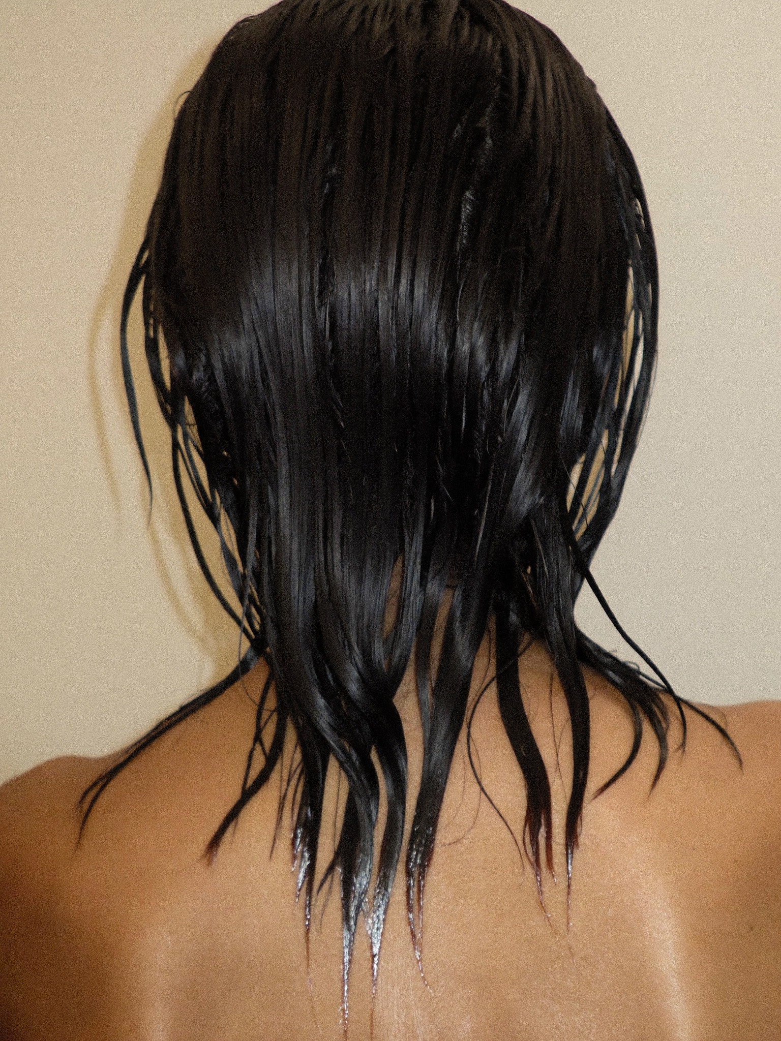 the hormones behind thinning hair